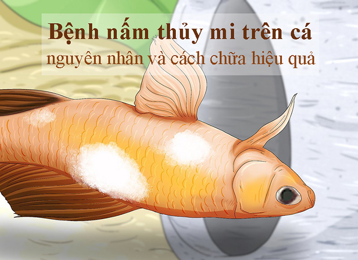 Điều trị Nấm Thủy Mi